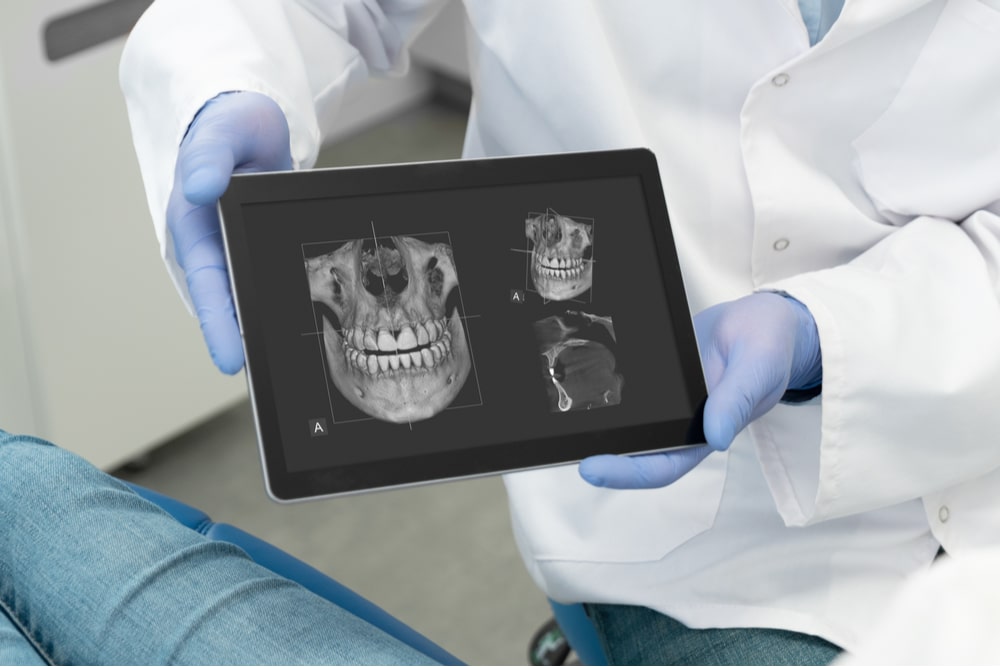 Dentist showing teeth x-ray on digital tablet screen